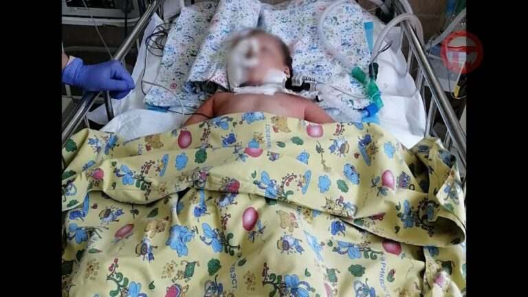 Нападение на ребенка. Бойцовская собака покалечила девочку